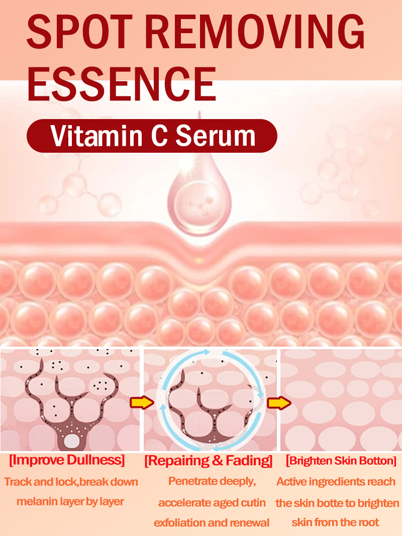 Schiarire le lentiggini Melasm - Luxury Skincare Essence recensione e prezzo